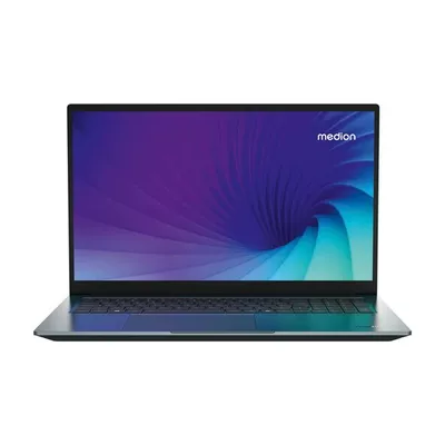 Medion Laptop S20, 43,94 cm (17,3'), Ultra 7 155H, (Md62640)